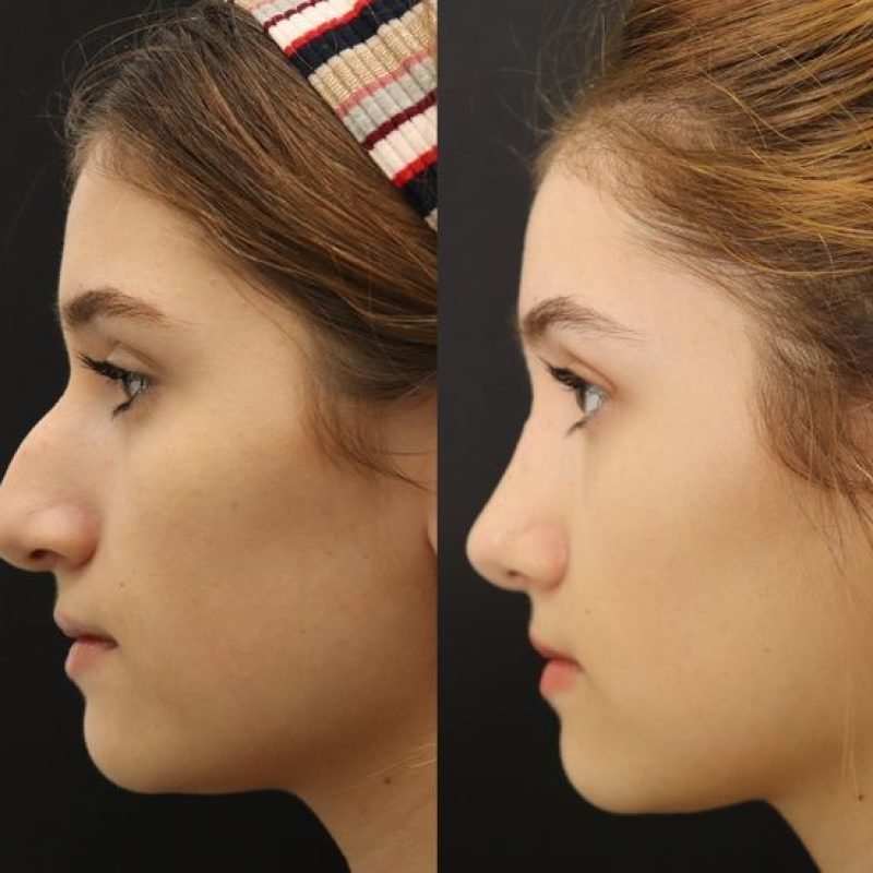 1e3112320190a8134f80373ad84dd8d6